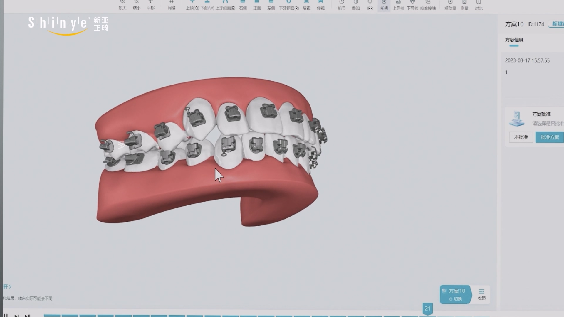 嘉兴正畸托槽引导装置三维动画口腔医疗设备展示案例截图
